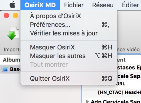 2-osirix-menu-preferences